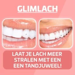 Nince DIY Tooth Gem Kit Hoogwaardig Materiaal - Wit Hart -Mooi Leven 1200x1200 1833