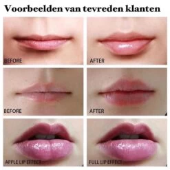 BenjaBeauty Lip Plumper - Lippen - Lipstick - Lippenbalsem - Rood - Wit -Mooi Leven 1200x1200 572